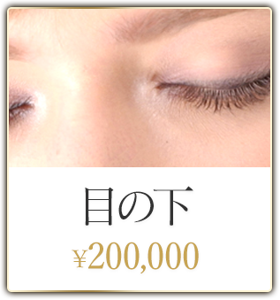 目の下 ¥200,000