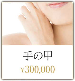 手の甲 ¥300,000